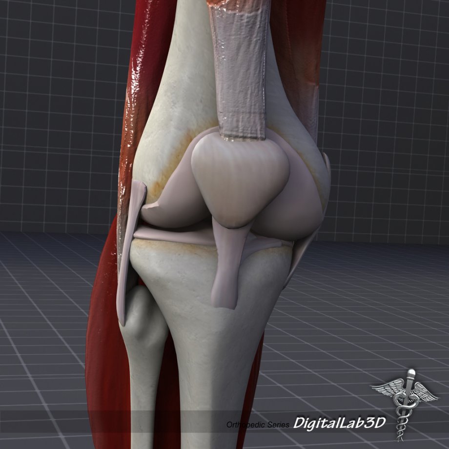 3D модель коленного сустава